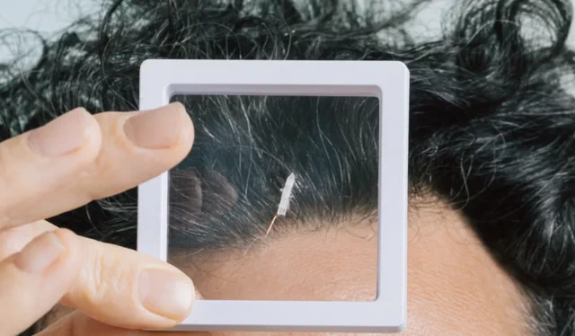 Robeauté's Rice-Sized Robot Navigates Brain to Fight Tumors